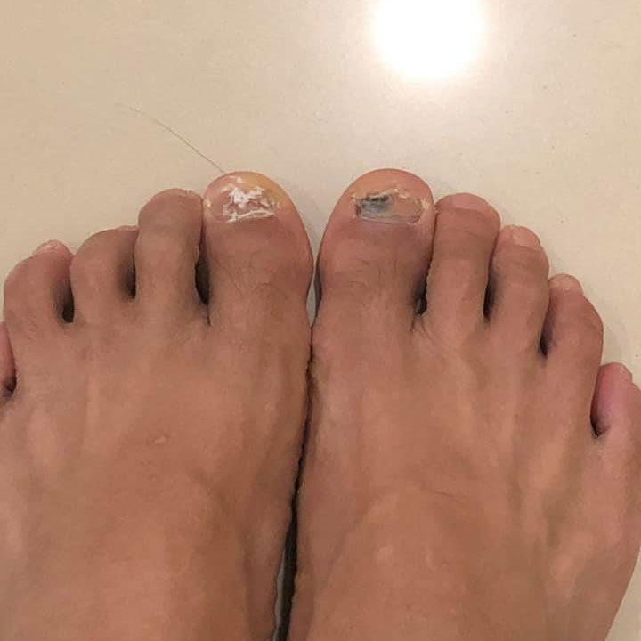 痛！期待我們能一起解決足部問題