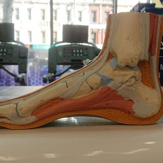 不同足弓高度模型